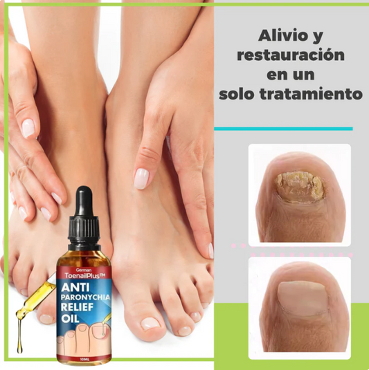 ToenailPlus™: Elimina los hongos de raíz | Paga 1 lleva 2