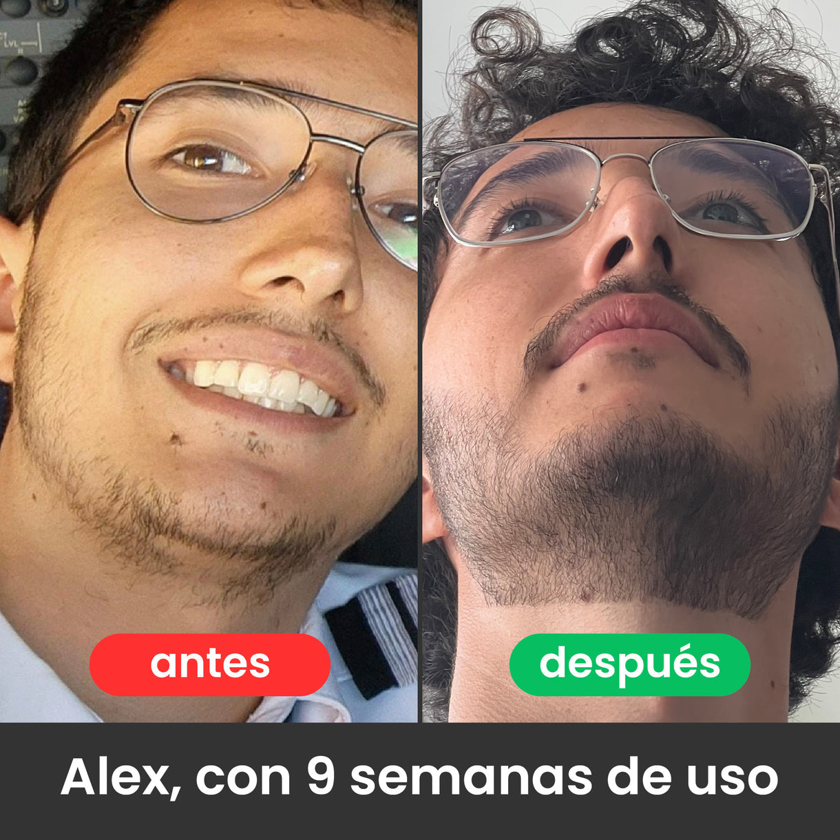 ESTIMULANTE DE BARBA APOLO | Barba poblada y masculina