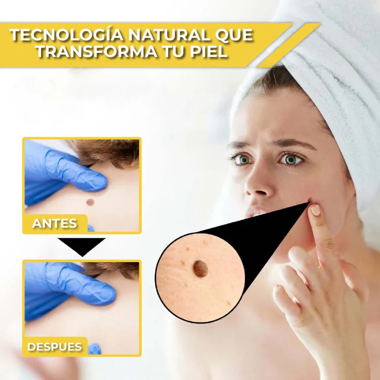 Tag Recede™: Spray Removedor de Verrugas